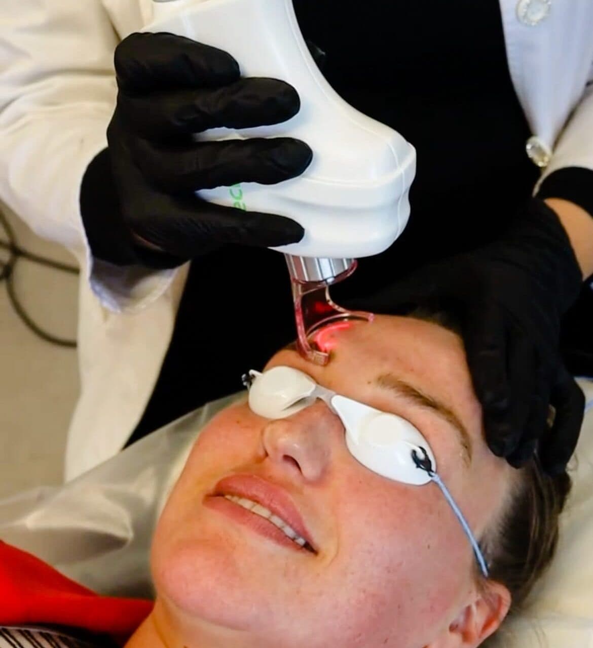 Laser treatment for post-summer skin recovery