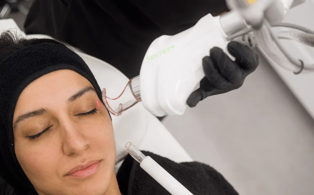 Laser resurfacing treatment on a patient